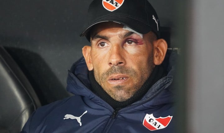 Carlitos, en el partido ante Barracas. (Foto: Marcelo Carroll)